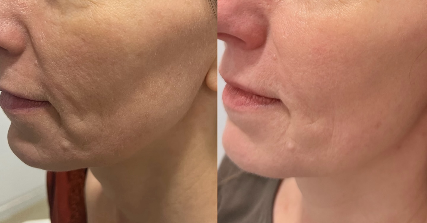 Konturowanie twarzy – przed i po